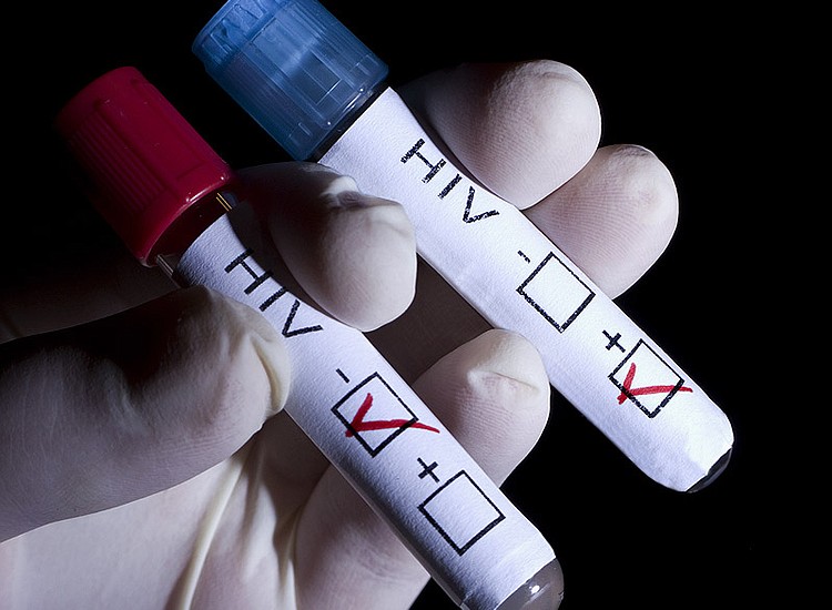 paciente con VIH entra en remisión